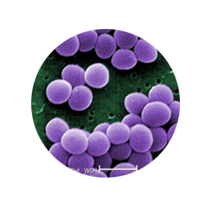 Aureus staphylococcus Staphylococcus Aureus